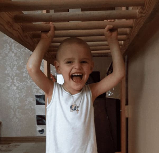 Microcephaly A Success Story IAHP